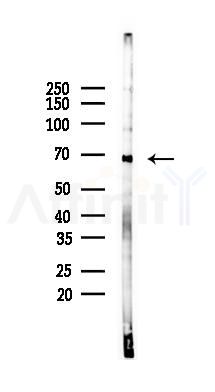 Estrogen Receptor-alpha Mouse monoclonal Antibody - Western blot analysis of lysates from COLO205 cells(starvation 24h treatment), using Estrogen Receptor-alpha Mouse monoclonal Antibody at 1/1000 dilution.