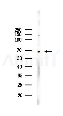 Estrogen Receptor-alpha Mouse monoclonal Antibody - Western blot analysis of lysates from K562 cells(LPS 4h treatment), using Estrogen Receptor-alpha Mouse monoclonal Antibody at 1/1000 dilution.