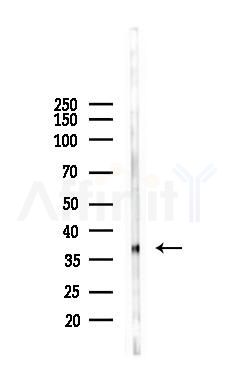 Nucleophosmin Mouse Monoclonal Antibody - Western blot analysis of lysates from K562 cells(starvation 24h treatment), using Nucleophosmin Mouse Monoclonal Antibody at 1/1000 dilution.