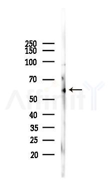 c-Myc Mouse Monoclonal Antibody - Western blot analysis of lysates from Mouse heart, using c-Myc Mouse Monoclonal Antibody at 1/1000 dilution.