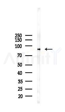 XRCC1 Mouse Monoclonal Antibody - Western blot analysis of lysates from K562 cells(starvation 24h treatment), using XRCC1 Mouse Monoclonal Antibody at 1/1000 dilution.