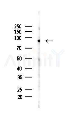 XRCC1 Mouse Monoclonal Antibody - Western blot analysis of lysates from B16F10-LUC cells(UV 30min treatment), using XRCC1 Mouse Monoclonal Antibody at 1/1000 dilution.