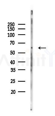FOXJ1 Mouse Monoclonal Antibody - Western blot analysis of lysates from PC12 cells(starvation 24h treatment), using FOXJ1 Mouse Monoclonal Antibody at 1/1000 dilution.