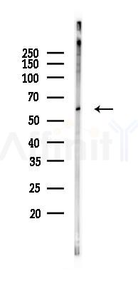 FOXJ1 Mouse Monoclonal Antibody - Western blot analysis of lysates from COLO205 cells(starvation 24h treatment), using FOXJ1 Mouse Monoclonal Antibody at 1/1000 dilution.