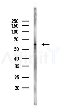 FOXJ1 Mouse Monoclonal Antibody - Western blot analysis of lysates from HUVEC cells(UV 30min treatment), using FOXJ1 Mouse Monoclonal Antibody at 1/1000 dilution.