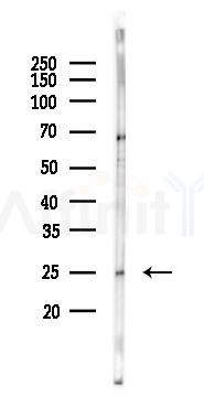 Glucagon Mouse Monoclonal Antibody - Western blot analysis of lysates from Rat lung, using Glucagon Mouse Monoclonal Antibody at 1/1000 dilution.