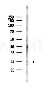 Glucagon Mouse Monoclonal Antibody - Western blot analysis of lysates from HepG2 cells(heat-shock 45min treatment), using Glucagon Mouse Monoclonal Antibody at 1/1000 dilution.