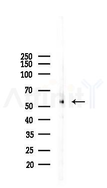 Estrogen Receptor-alpha Antibody - Western blot analysis of lysates from K562 cells(starvation 24h treatment), using Estrogen Receptor-alpha Antibody at 1/1000 dilution.