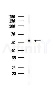 Estrogen Receptor-alpha Antibody - Western blot analysis of lysates from B16F10-LUC cells(UV 30min treatment), using Estrogen Receptor-alpha Antibody at 1/1000 dilution.