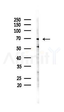 TLS/FUS Mouse Monoclonal Antibody - Western blot analysis of lysates from B16F10-LUC cells(UV 30min treatment), using TLS/FUS Mouse Monoclonal Antibody at 1/1000 dilution.