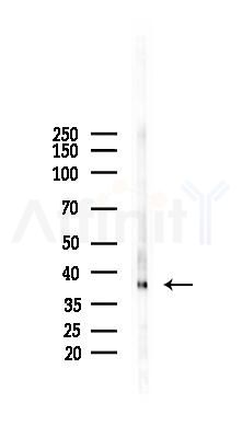 ALDOA Mouse Monoclonal Antibody - Western blot analysis of lysates from K562 cells(starvation 24h treatment), using ALDOA Mouse Monoclonal Antibody at 1/1000 dilution.