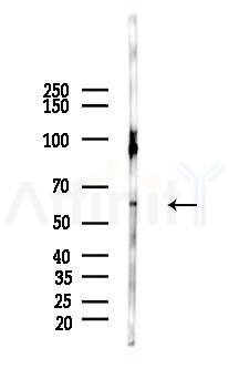YTHDF1 Mouse Monoclonal Antibody - Western blot analysis of lysates from Mouse liver, using YTHDF1 Mouse Monoclonal Antibody at 1/1000 dilution.