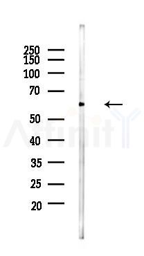 YTHDF1 Mouse Monoclonal Antibody - Western blot analysis of lysates from 293 cells(heat-shock 45min treatment), using YTHDF1 Mouse Monoclonal Antibody at 1/1000 dilution.