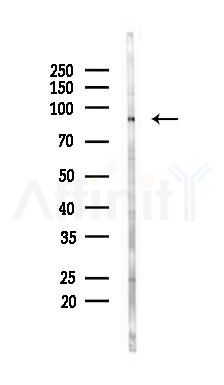 ANO9 Mouse Monoclonal Antibody - Western blot analysis of lysates from B16F10-LUC cells(UV 30min treatment), using ANO9 Mouse Monoclonal Antibody at 1/1000 dilution.