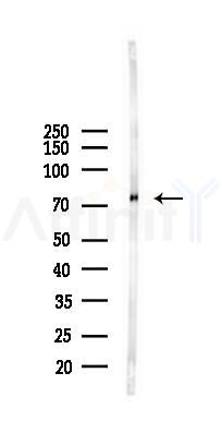 Zyxin Mouse Monoclonal Antibody - Western blot analysis of lysates from K562 cells(starvation 24h treatment), using Zyxin Mouse Monoclonal Antibody at 1/1000 dilution.