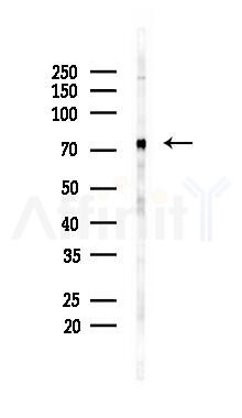 Zyxin Mouse Monoclonal Antibody - Western blot analysis of lysates from B16F10-LUC cells(UV 30min treatment), using Zyxin Mouse Monoclonal Antibody at 1/1000 dilution.