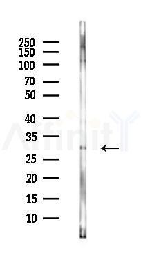 COX6C Mouse Monoclonal Antibody - Western blot analysis of lysates from PC12 cells(heat-shock 45min treatment), using COX6C Mouse Monoclonal Antibody at 1/1000 dilution.