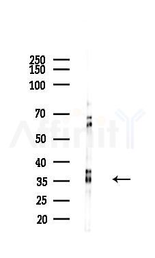 ELAVL1 Mouse Monoclonal Antibody - Western blot analysis of lysates from Rat spleen, using ELAVL1 Mouse Monoclonal Antibody at 1/1000 dilution.
