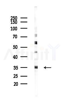 ELAVL1 Mouse Monoclonal Antibody - Western blot analysis of lysates from Rat lung, using ELAVL1 Mouse Monoclonal Antibody at 1/1000 dilution.