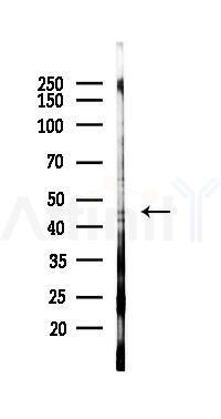 AGTR1 Mouse Monoclonal Antibody - Western blot analysis of lysates from 293 cells(UV 30min treatment), using AGTR1 Mouse Monoclonal Antibody at 1/1000 dilution.