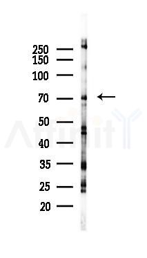 PTHR1 Mouse Monoclonal Antibody - Western blot analysis of lysates from 293 cells(UV 30min treatment), using PTHR1 Mouse Monoclonal Antibody at 1/1000 dilution.