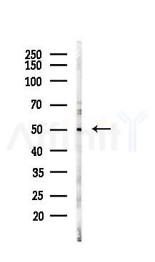 HCRTR1 Mouse Monoclonal Antibody - Western blot analysis of lysates from 293 cells(UV 30min treatment), using HCRTR1 Mouse Monoclonal Antibody at 1/1000 dilution.