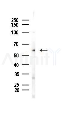 ATP5A1 Mouse Monoclonal Antibody - Western blot analysis of lysates from B16F10-LUC cells(UV 30min treatment), using ATP5A1 Mouse Monoclonal Antibody at 1/1000 dilution.