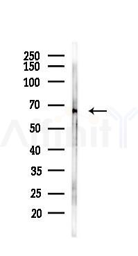 CYP1B1 Mouse Monoclonal Antibody - Western blot analysis of lysates from 293 cells(UV 30min treatment), using CYP1B1 Mouse Monoclonal Antibody at 1/1000 dilution.
