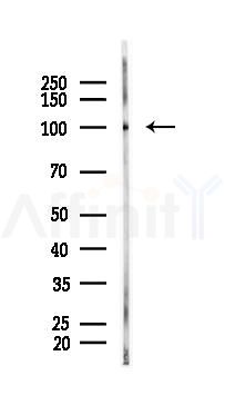 Factor B/CFB Mouse Monoclonal Antibody - Western blot analysis of lysates from B16F10-LUC cells(UV 30min treatment), using Factor B/CFB Mouse Monoclonal Antibody at 1/1000 dilution.