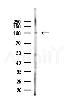 Factor B/CFB Mouse Monoclonal Antibody - Western blot analysis of lysates from 293 cells(UV 30min treatment), using Factor B/CFB Mouse Monoclonal Antibody at 1/1000 dilution.