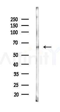 AIFM1 Mouse Monoclonal Antibody - Western blot analysis of lysates from Mouse liver, using AIFM1 Mouse Monoclonal Antibody at 1/1000 dilution.