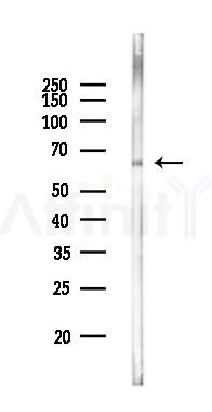 AIFM1 Mouse Monoclonal Antibody - Western blot analysis of lysates from PC12 cells(starvation 24h treatment), using AIFM1 Mouse Monoclonal Antibody at 1/1000 dilution.