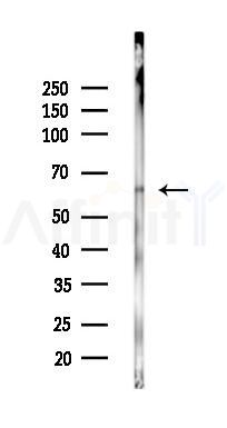 AIFM1 Mouse Monoclonal Antibody - Western blot analysis of lysates from HepG2 cells(heat-shock 45min treatment), using AIFM1 Mouse Monoclonal Antibody at 1/1000 dilution.