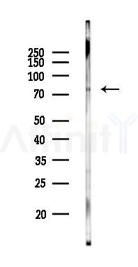 Zyxin Mouse Monoclonal Antibody - Western blot analysis of lysates from PC12 cells(starvation 24h treatment), using Zyxin Mouse Monoclonal Antibody at 1/1000 dilution.