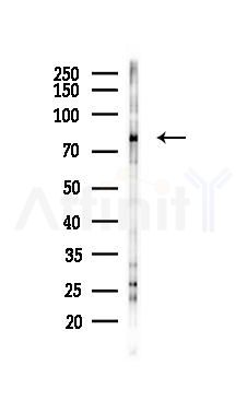 ZNF600 Mouse Monoclonal Antibody - Western blot analysis of lysates from 293 cells(UV 30min treatment), using ZNF600 Mouse Monoclonal Antibody at 1/1000 dilution.