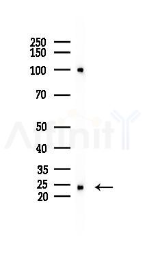 RHOF Mouse Monoclonal Antibody - Western blot analysis of lysates from B16F10-LUC cells(UV 30min treatment), using RHOF Mouse Monoclonal Antibody at 1/1000 dilution.