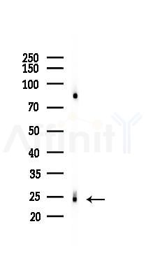 RHOF Mouse Monoclonal Antibody - Western blot analysis of lysates from 293 cells(UV 30min treatment), using RHOF Mouse Monoclonal Antibody at 1/1000 dilution.