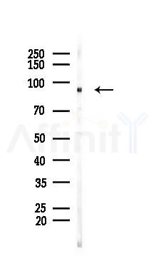 ATXN7L1 Mouse Monoclonal Antibody - Western blot analysis of lysates from B16F10-LUC cells(UV 30min treatment), using ATXN7L1 Mouse Monoclonal Antibody at 1/1000 dilution.