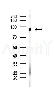 ATXN7L1 Mouse Monoclonal Antibody - Western blot analysis of lysates from B16F10-LUC cells(UV 30min treatment), using ATXN7L1 Mouse Monoclonal Antibody at 1/1000 dilution.