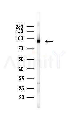 ATXN7L1 Mouse Monoclonal Antibody - Western blot analysis of lysates from 293 cells(UV 30min treatment), using ATXN7L1 Mouse Monoclonal Antibody at 1/1000 dilution.