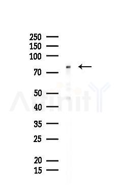 IKK-beta Mouse Monoclonal Antibody - Western blot analysis of lysates from Mouse testis, using IKK-beta Mouse Monoclonal Antibody at 1/1000 dilution.