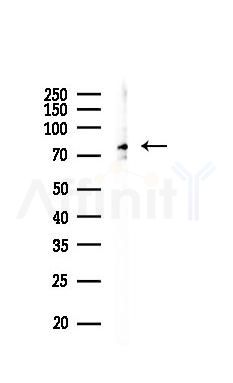 IKK-beta Mouse Monoclonal Antibody - Western blot analysis of lysates from COLO205 cells(UV 30min treatment), using IKK-beta Mouse Monoclonal Antibody at 1/1000 dilution.