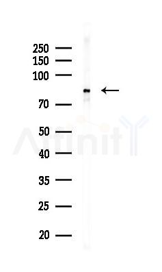 IKK-beta Mouse Monoclonal Antibody - Western blot analysis of lysates from Rat brain, using IKK-beta Mouse Monoclonal Antibody at 1/1000 dilution.