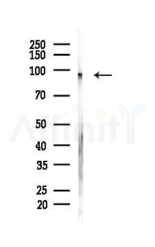 SFRS18 Mouse Monoclonal Antibody - Western blot analysis of lysates from HUVEC cells(starvation 24h treatment), using SFRS18 Mouse Monoclonal Antibody at 1/1000 dilution.