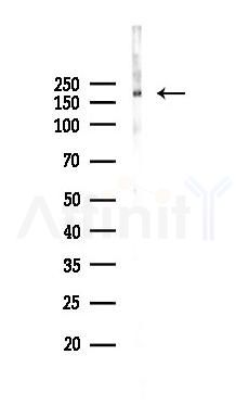 Collagen V  alpha 1 Mouse Monoclonal Antibody - Western blot analysis of lysates from Rat kidney, using Collagen V  alpha 1 Mouse Monoclonal Antibody at 1/1000 dilution.