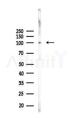 Insulin Receptor beta Mouse Monoclonal Antibody - Western blot analysis of lysates from HUVEC cells(starvation 24h treatment), using Insulin Receptor beta Mouse Monoclonal Antibody at 1/1000 dilution.