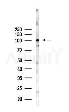 NF kappaB p105/p50 Mouse Monoclonal Antibody - Western blot analysis of lysates from HUVEC cells(starvation 24h treatment), using NF kappaB p105/p50 Mouse Monoclonal Antibody at 1/1000 dilution.