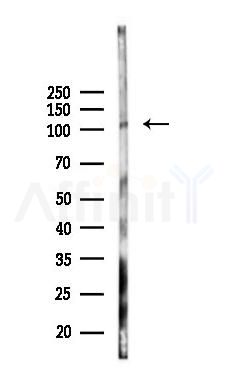 PKD1/PKC mu Mouse Monoclonal Antibody - Western blot analysis of lysates from HUVEC cells(starvation 24h treatment), using PKD1/PKC mu Mouse Monoclonal Antibody at 1/1000 dilution.