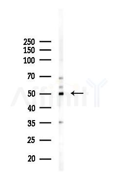 GSK3 alpha Mouse Monoclonal Antibody - Western blot analysis of lysates from HUVEC cells(starvation 24h treatment), using GSK3 alpha Mouse Monoclonal Antibody at 1/1000 dilution.