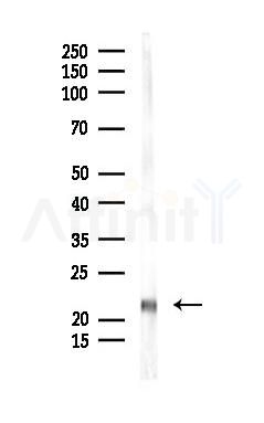 Cofilin Mouse Monoclonal Antibody - Western blot analysis of lysates from Mouse testis, using Cofilin Mouse Monoclonal Antibody at 1/1000 dilution.